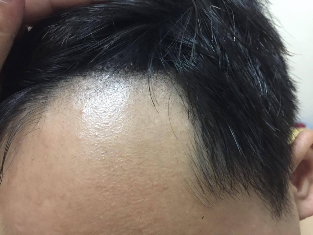 DOMO FIBER 電動髮粉 體驗心得分享 纖維假髮 / 增髮神器/ 瞬間增髮/ 極速炫豐 韓國原裝 3C相關 彩妝品分享 自己動手做！ 