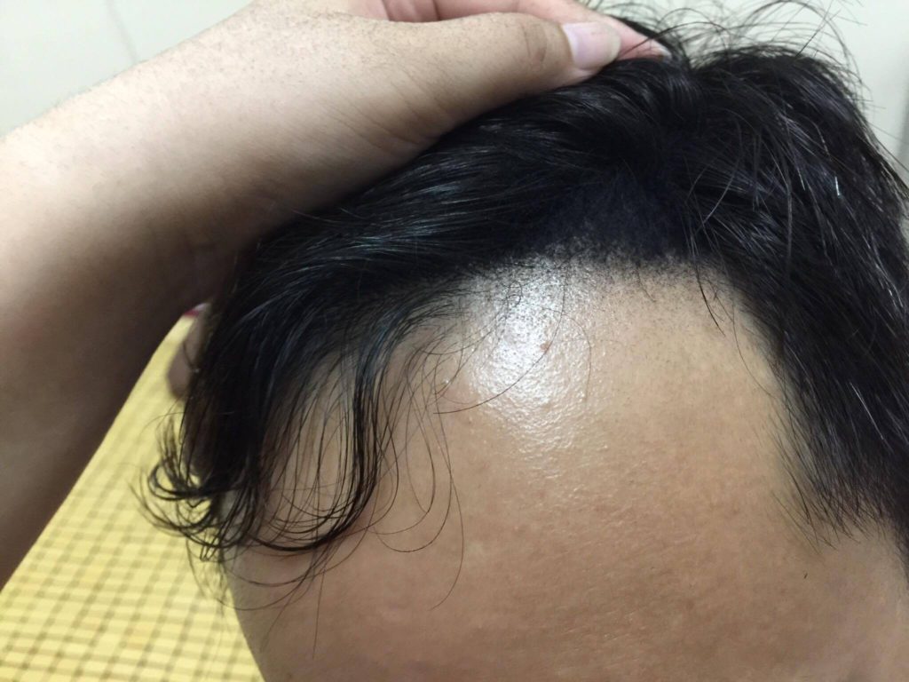 DOMO FIBER 電動髮粉 體驗心得分享 纖維假髮 / 增髮神器/ 瞬間增髮/ 極速炫豐 韓國原裝 3C相關 彩妝品分享 自己動手做!