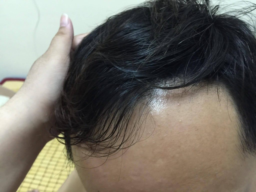 DOMO FIBER 電動髮粉 體驗心得分享 纖維假髮 / 增髮神器/ 瞬間增髮/ 極速炫豐 韓國原裝 3C相關 彩妝品分享 自己動手做!