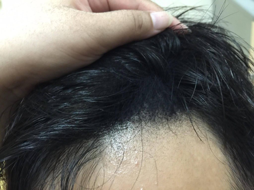 DOMO FIBER 電動髮粉 體驗心得分享 纖維假髮 / 增髮神器/ 瞬間增髮/ 極速炫豐 韓國原裝 3C相關 彩妝品分享 自己動手做!