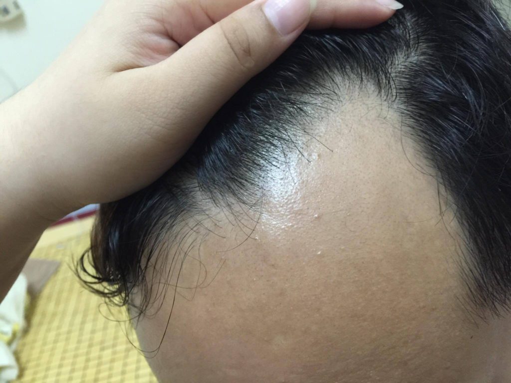 DOMO FIBER 電動髮粉 體驗心得分享 纖維假髮 / 增髮神器/ 瞬間增髮/ 極速炫豐 韓國原裝 3C相關 彩妝品分享 自己動手做!