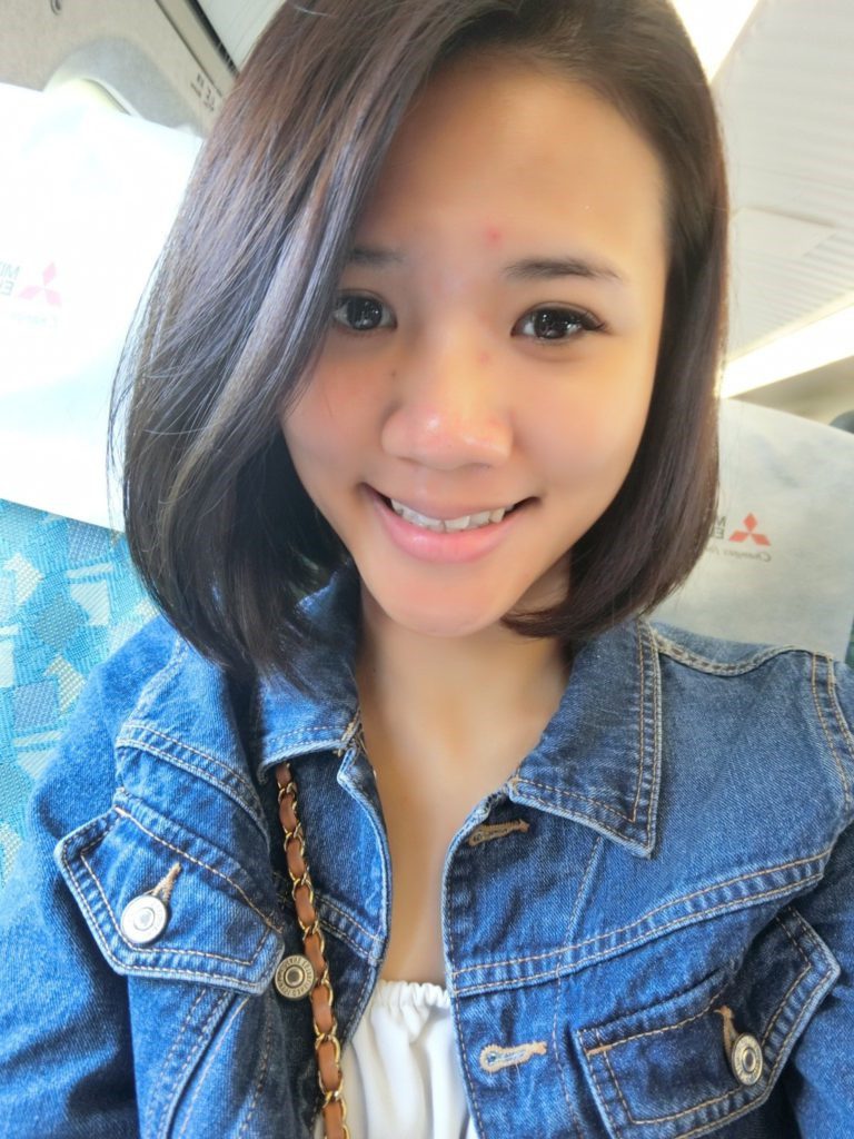 台中醫美/峻美診所-勇敢追夢with卡麥拉隆鼻,重新蛻變自我,找回自信新生感! 民生資訊分享 醫美