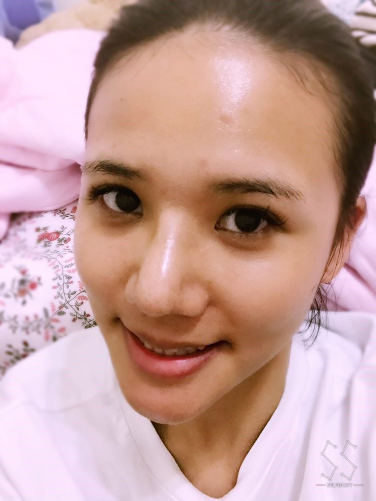 台中醫美/峻美診所-勇敢追夢with卡麥拉隆鼻，重新蛻變自我，找回自信新生感！ 民生資訊分享 醫美 