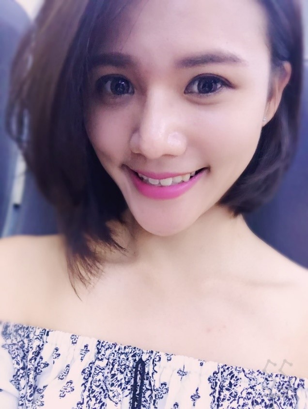 台中醫美/峻美診所-勇敢追夢with卡麥拉隆鼻，重新蛻變自我，找回自信新生感！ 民生資訊分享 醫美 
