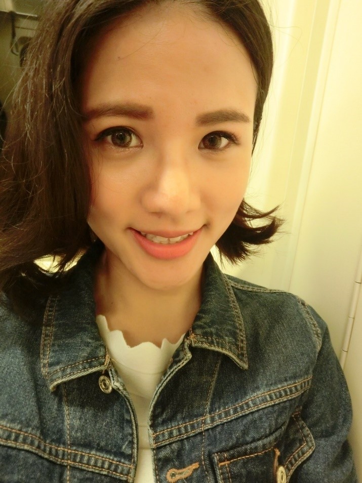 台中醫美/峻美診所-勇敢追夢with卡麥拉隆鼻,重新蛻變自我,找回自信新生感! 民生資訊分享 醫美