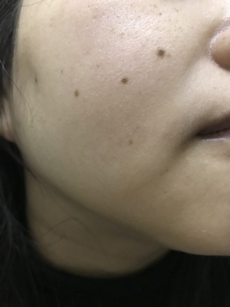 lalune蘭韻雛菊花淨白提亮面膜 舒適的感受讓人回購感爆棚 保養品分享 民生資訊分享