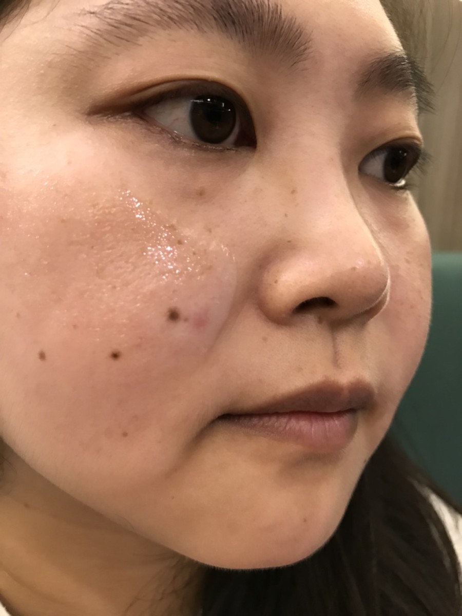 Facial care-想找敏感肌適用的夏季保養?也許蓓樂膚PURIFY出品的水漾舒護系列無酒精保養品值得你嘗試看看! 保養品分享 攝影 民生資訊分享