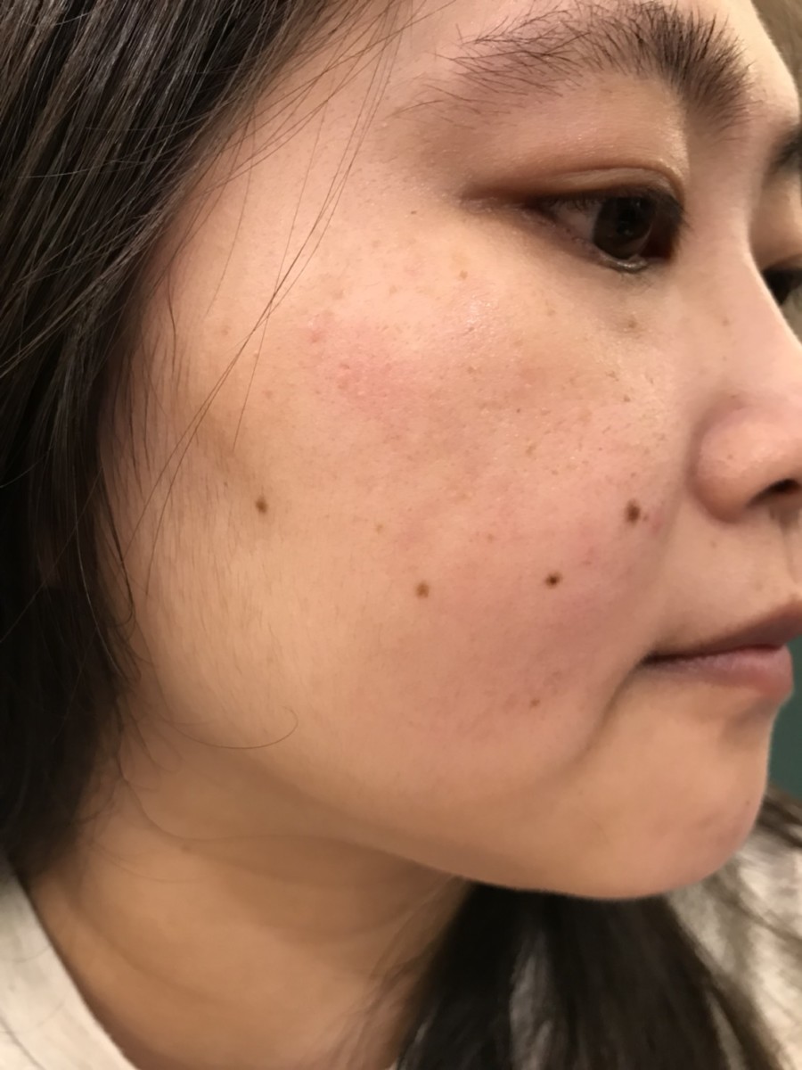 Facial care-想找敏感肌適用的夏季保養?也許蓓樂膚PURIFY出品的水漾舒護系列無酒精保養品值得你嘗試看看! 保養品分享 攝影 民生資訊分享