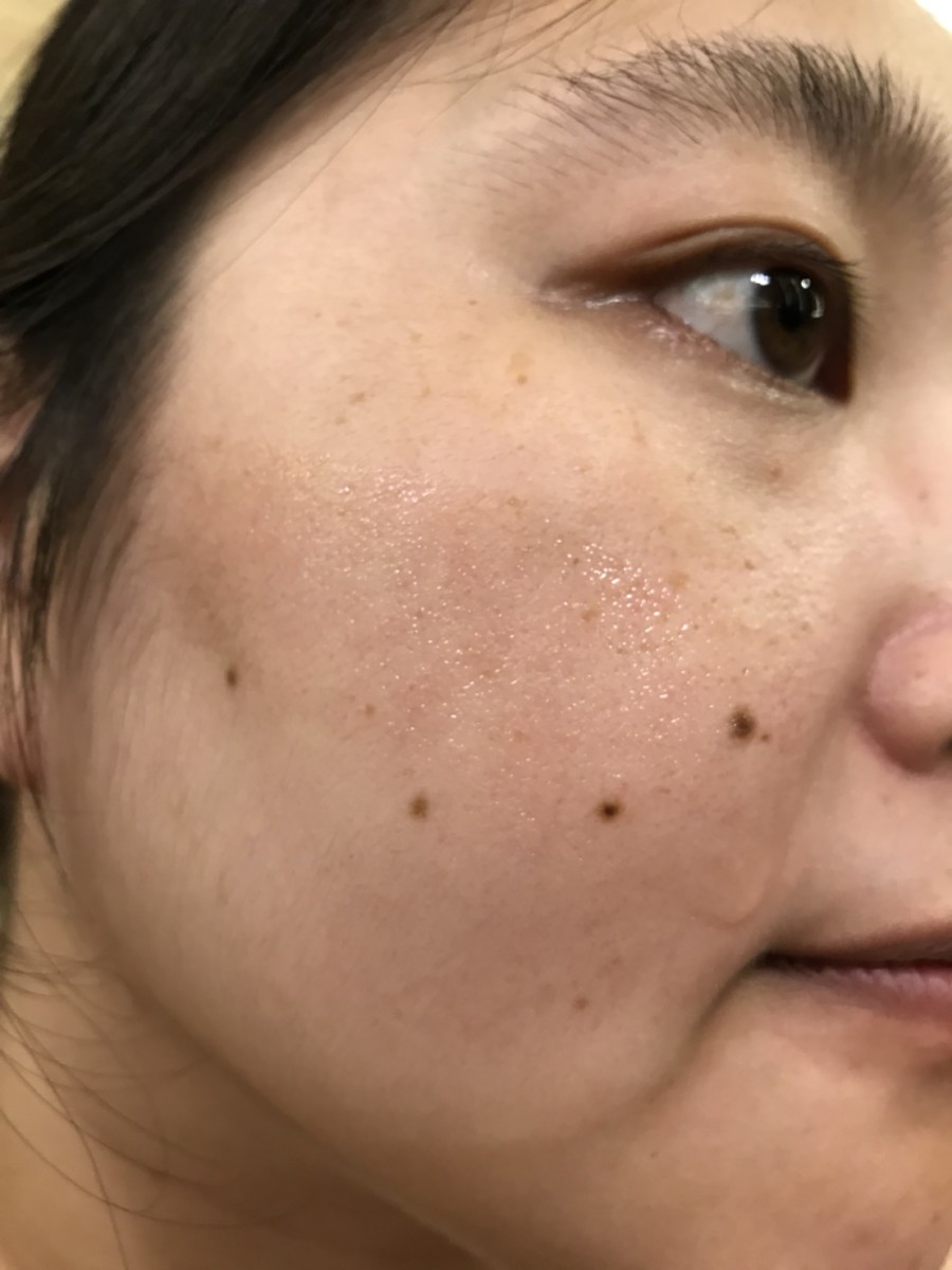 skincare/夏天保養/Hera Care 極緻奇蹟精華液/Arctic Miracle Essence 舒適好用的保濕精華,保濕做的好,透亮沒煩惱 保養品分享 攝影 民生資訊分享