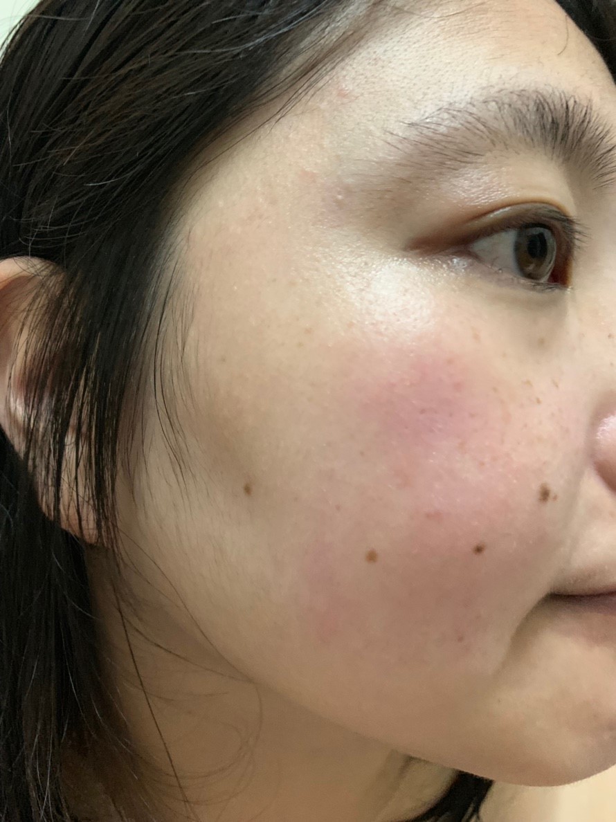 AVON雅芳極酵青春美顏露-女性愛用20年，日本原裝進口的頂級護膚品！酵母發酵液/青春水/美顏水 保養品分享 彩妝品 彩妝品分享 攝影 民生資訊分享 