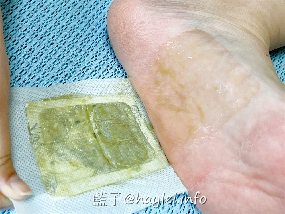 翰方御品/御醫足貼、粉晶刮痧板-曾柏翰醫師領協中醫團隊研發的人蔘足貼用料超實在,搭配刮痧板舒緩腿部壓力、促進下半身代謝,讓足部重拾輕盈,恢復活力感受!美妝保養/身體保養/足部保養好物推薦/藍子愛保養 保養品分享 健康養身 彩妝品 彩妝品分享 攝影 民生資訊分享