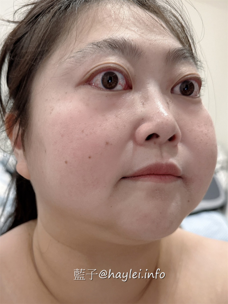韓國保養品分享/MEDITHERAPY角鯊烷屏障安膚霜-裡面有8%角鯊烷幫助強化屏障保養，清爽不黏膩的使用感受很加分，是款敏弱肌適用日常修護、穩定膚況的乳霜~藍子愛保養/肌膚保養/美妝保養/日常護膚 保養品分享 健康養身 彩妝品分享 攝影 民生資訊分享 
